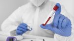 Sanità / Punto prelievi screening prevenzione tumore al colon